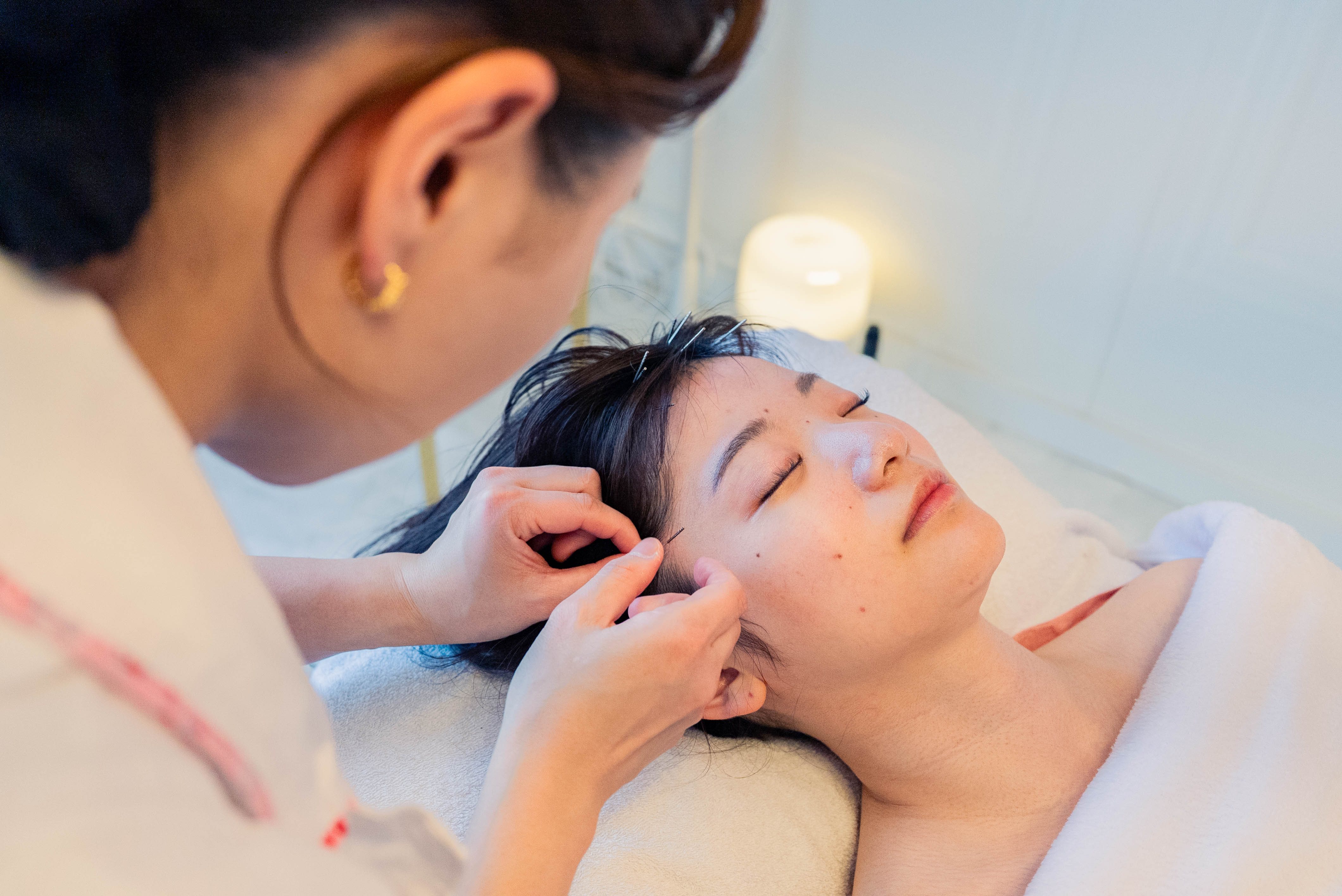 美容鍼灸の施術